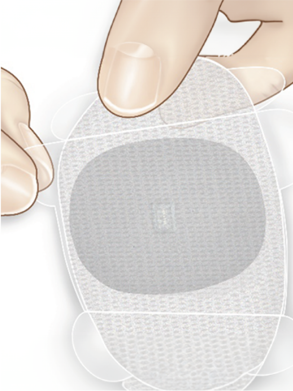 A hand applies a circular adhesive patch with a central CGM sensor, against a white background.